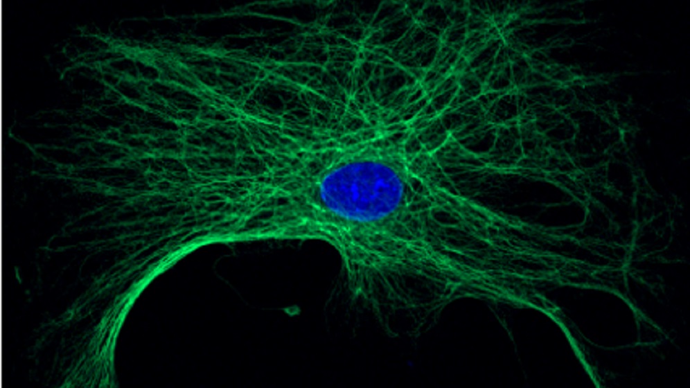 cultured-senescence-cell